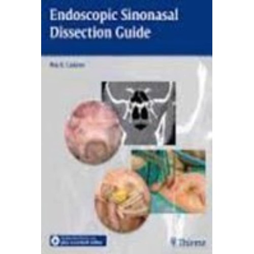 Endoscopic Sinonasal Dissection Guide