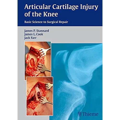 Articular Cartilage Injury of the Knee: Basic...