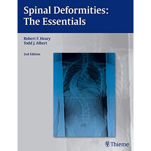 Spinal Deformities The Essentials, 2nd Editio...