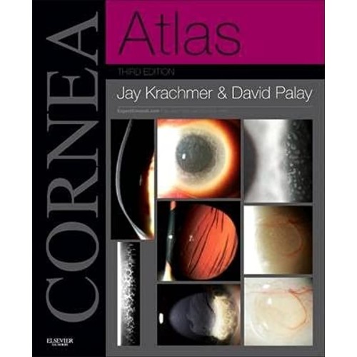 Cornea Atlas 3/e