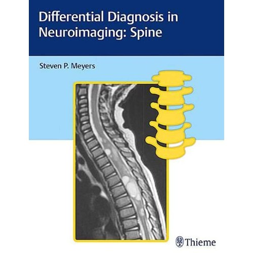 Differential Diagnosis in Neuroimaging Spine 1st Edition