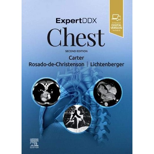 ExpertDDx: Chest-2E