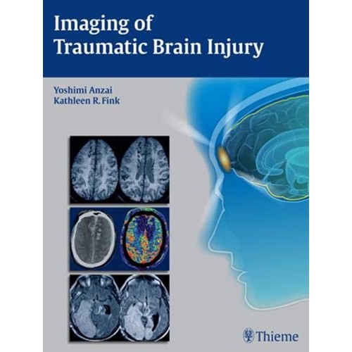 Imaging of Traumatic Brain Injury