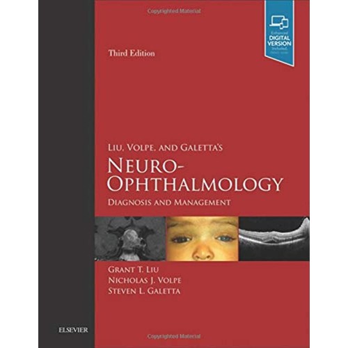 Liu, Volpe, and Galetta's Neuro-Ophthalmology -3E