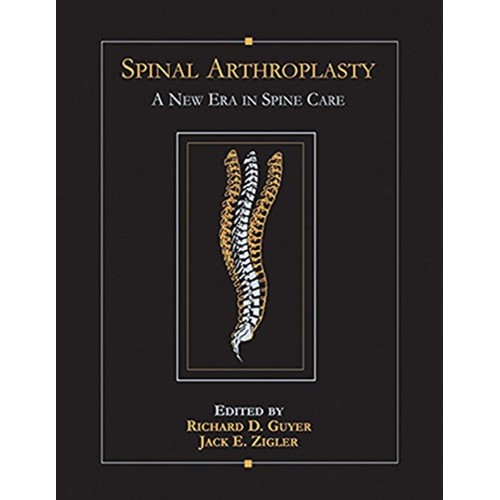 Spinal Arthroplasty 1st Edition