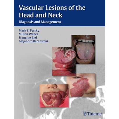 Vascular Lesions of the Head and Neck