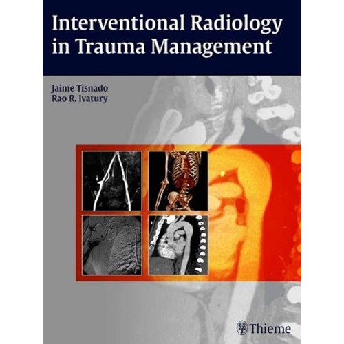 Interventional Radiology in Trauma Management