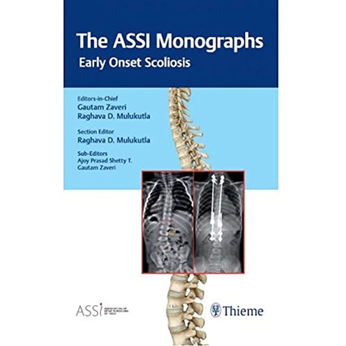 The ASSI Monographs—Early Onset Scoliosis