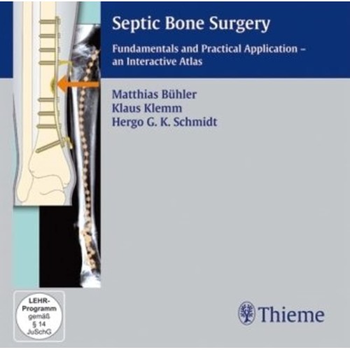 Septic Bone Surgery CD-ROM