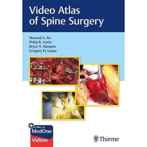 Video Atlas of Spine Surgery 1st Ed.