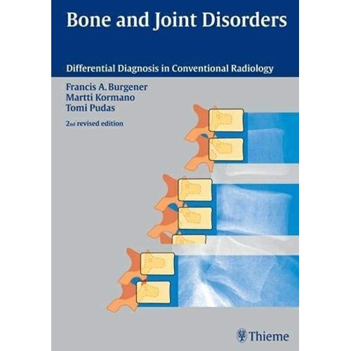 Bone and Joint Disorders