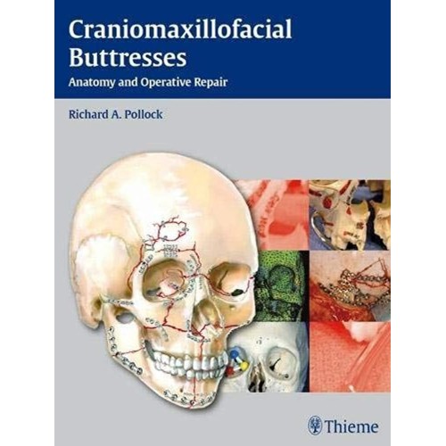 Craniomaxillofacial Buttresses