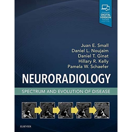 Neuroradiology: Spectrum and Evolution of Disease - 1E