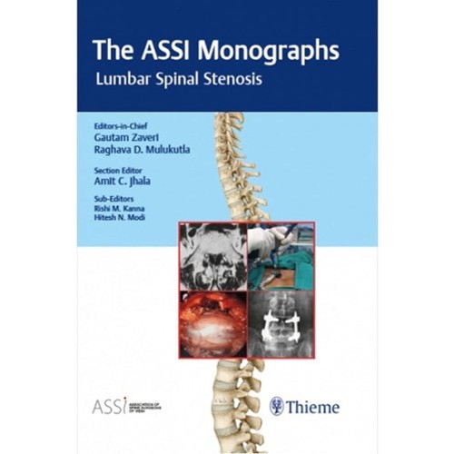 The ASSI Monographs-Lumbar Spinal Stenosis