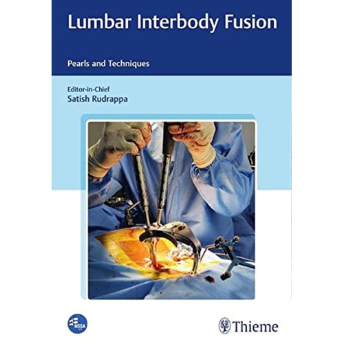 Lumbar Interbody Fusion 1st Ed.