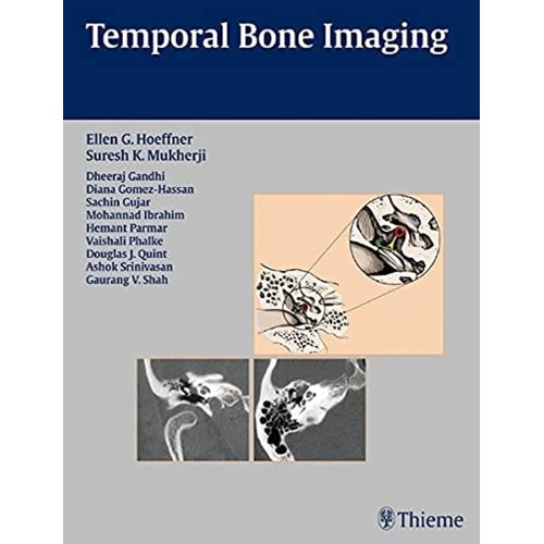 Temporal Bone Imaging