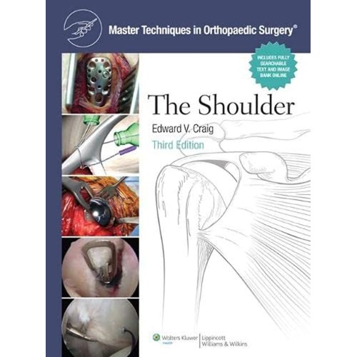 The Master Techniques In Orthopaedic Surgery: Shoulder (Master Techniques In Orthopaedic Surgery)