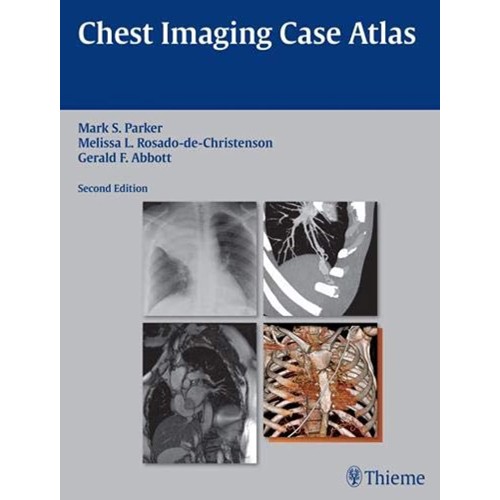 Chest Imaging Case Atlas 2ed.