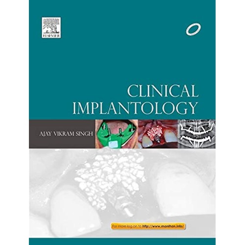 Clinical Implantology IE