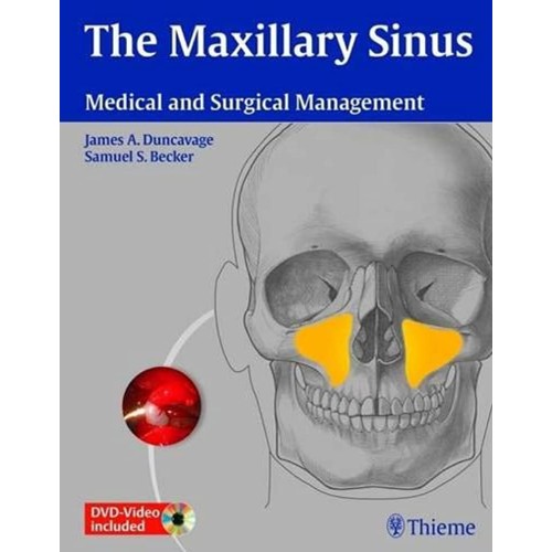 The Maxillary Sinus Med & Surgical