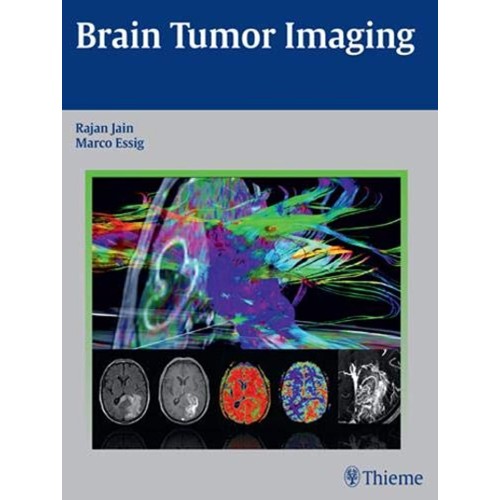 Brain Tumor Imaging 1st Ed.