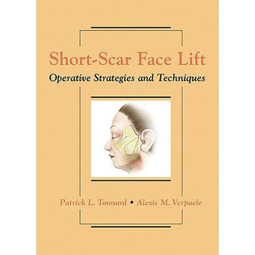 Short-Scar Face Lift : Operative Strategies a...