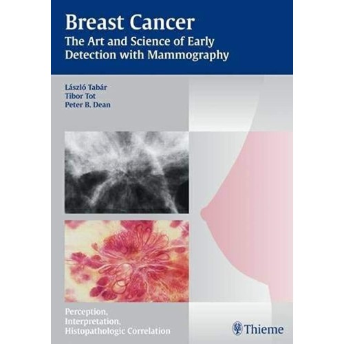 Breast Cancer - The Art and Science of Early ...