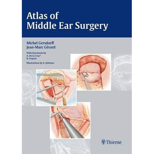 Atlas of Middle ear Surgery