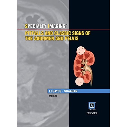 Specialty Imaging: Pitfalls and Classic Signs of the Abdomen and Pelvis - 1E