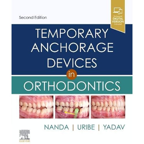 Temporary Anchorage Devices in Orthodontics - 2E