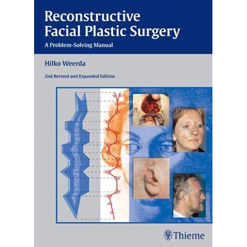 Reconstructive Facial Plastic Surgery 2nd Edi...