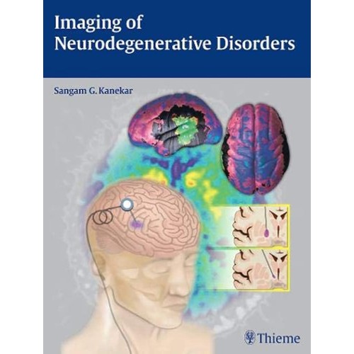 Imaging of Neurodegenerative Disorders