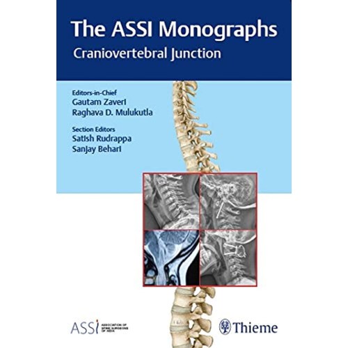 The ASSI Monographs—Craniovertebral Junctio...