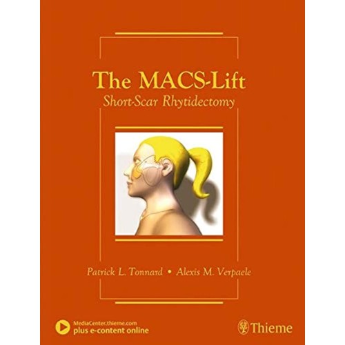 The MACS-Lift Short-Scar Rhytidectomy 1st Edi...