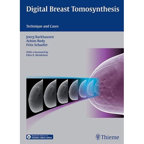 Digital Breast Tomosynthesis: Technique and Cases