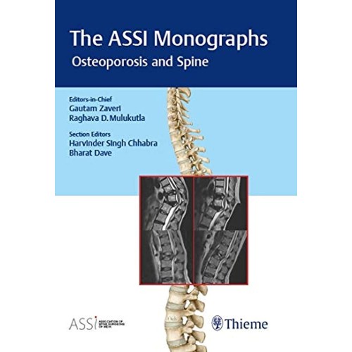 The ASSI Monographs - Osteoporosis and Spine