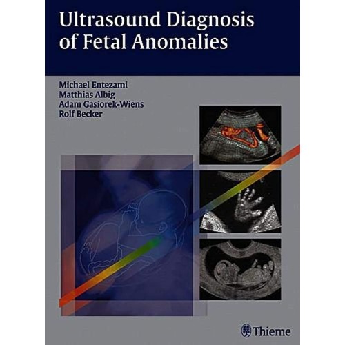 Ultrasound Diagnosis of Fetal Anomalies