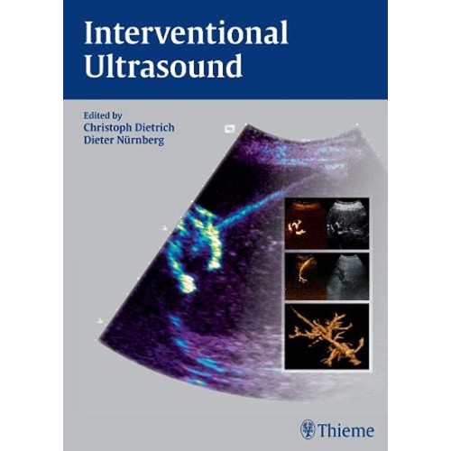 Interventional Ultrasound