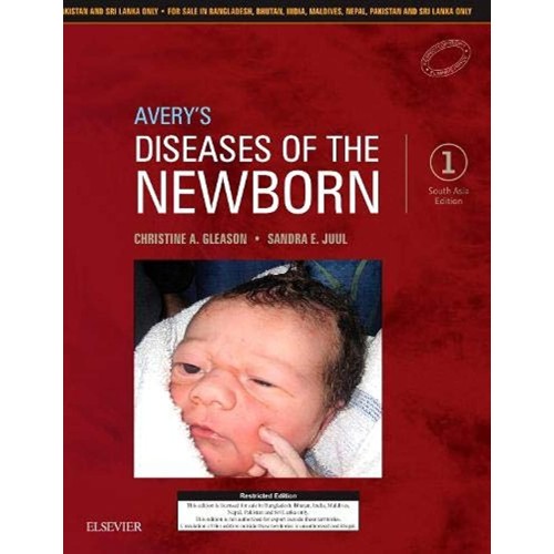 Avery's Diseases of the Newborn(SAE) -1E