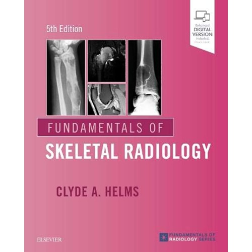 Fundamentals of Skeletal Radiology- 5E