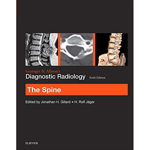 Grainger & Allisons Diagnostic Radiology: The Spine - 6E