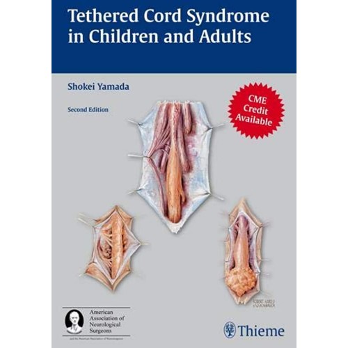 TETHERED CORD SYNDRME IN CHILDREN AND ADULTS