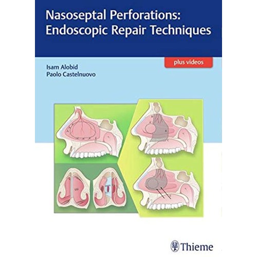 Nasoseptal Perforations: Endoscopic Repair Techniques 1st Edition