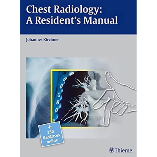 Radcases Chest Radiology A Residents Manual