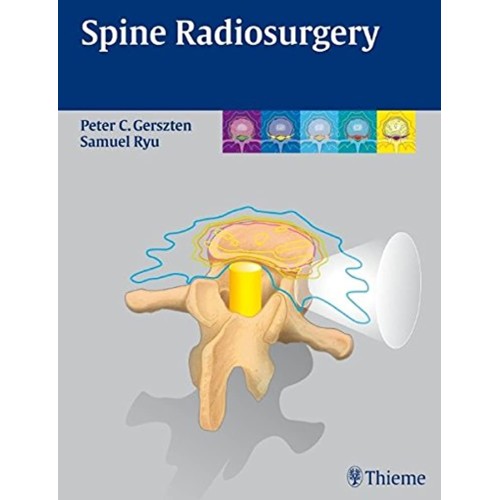 Spine Radiosurgery