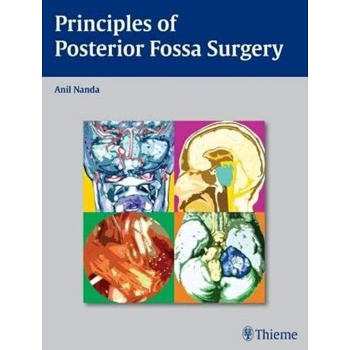 Principles of Posterior Fossa surgery