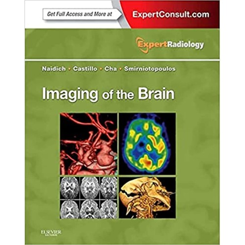 Imaging of the Brain