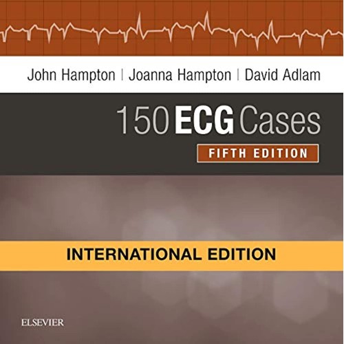 150 ECG Cases(IE) -5E