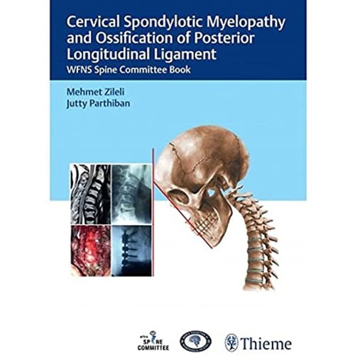 Cervical Spondylotic Myelopathy and OPLL 1st Ed.