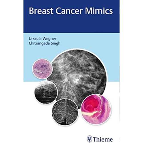 Breast Cancer Mimics 1st Ed.